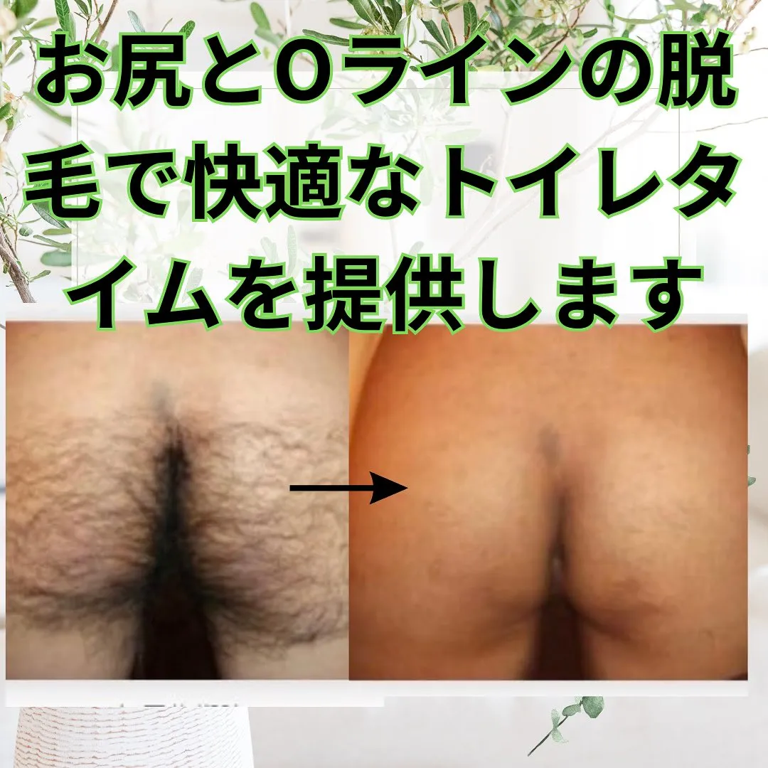 お尻とOラインが繋がってしまっている方もー脱毛して下さい笑