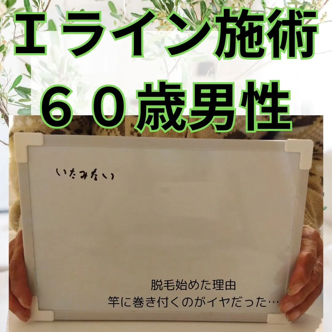 Ｉライン脱毛している６０歳男性。